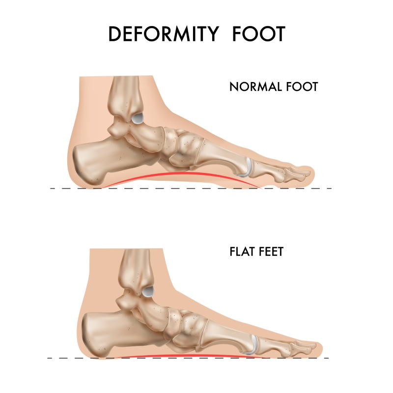 Deformity Correction Procedures