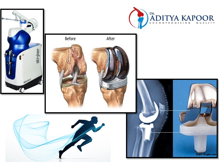 robotic orthopedic surgery benefits