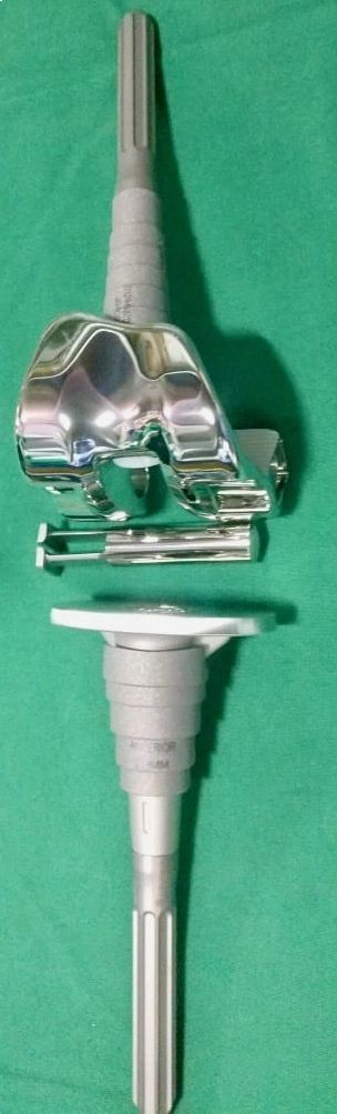 Revision Knee Replacement Implant